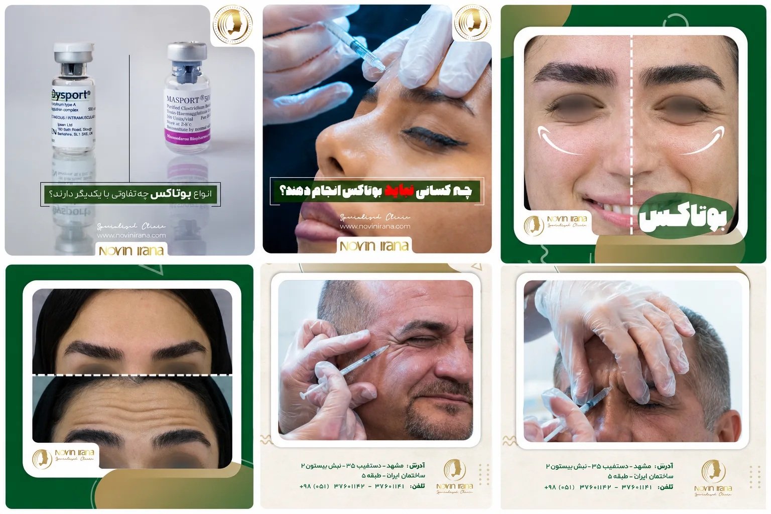 گالری عکس قبل و بعد